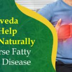 How Ayurveda Can Help You Naturally Reverse Fatty Liver Disease